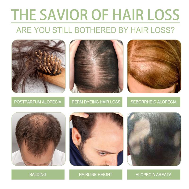 新しい100ml育毛オイル インドアディヴァシハーブヘアケア - Hair Care India のレビューと価格