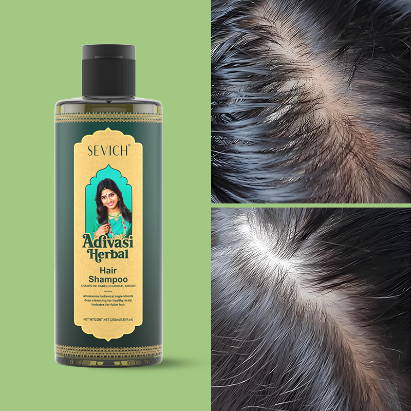 育毛オイルセット ローズマリー育毛オイル 天然ハーブヘアケア - Hair Care India のレビューと価格